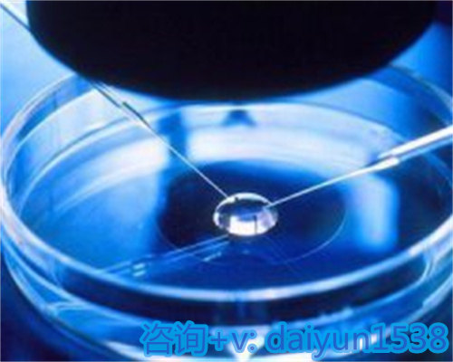 温州孕妈代怀机构,「xy精子达到卵子的时间」同房后y精子和x精子谁先到达卵子