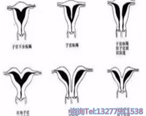 回顾：37岁女子怀孕5个月，B超检查后温州提供供卵试管价格离奇消失，结局怎