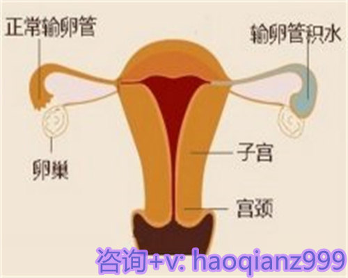 试管婴儿反复失败该怎么办?