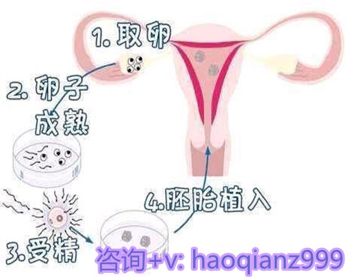〔宝宝对眼看什么科〕,48岁做试管成功率多少元 48岁做试管成功率多少元正常